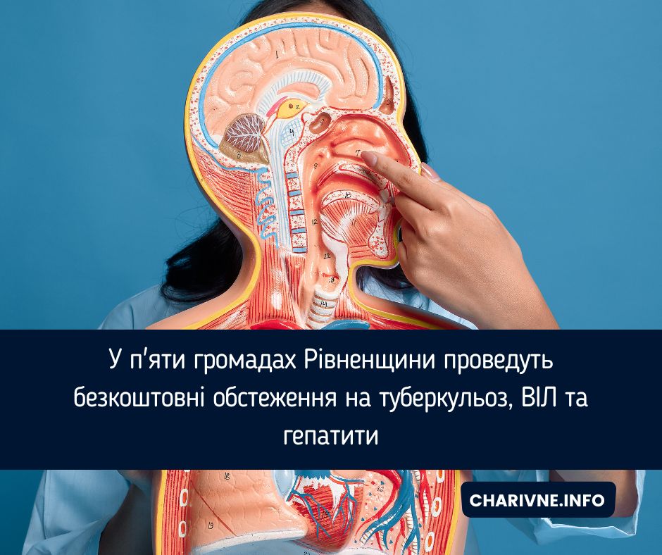 У п'яти громадах Рівненщини проведуть безкоштовні обстеження на туберкульоз, ВІЛ та гепатити