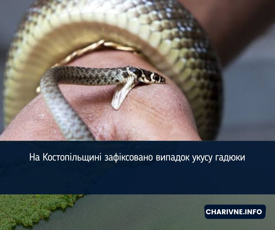 На Костопільщині зафіксовано випадок укусу гадюки