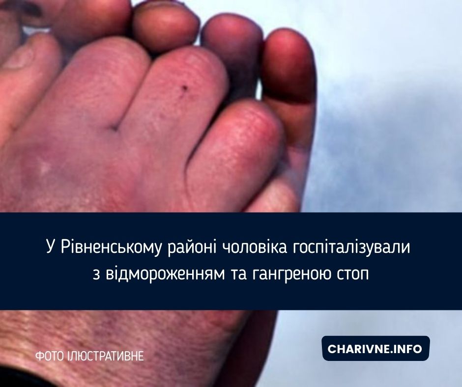 Фото ілюстративне