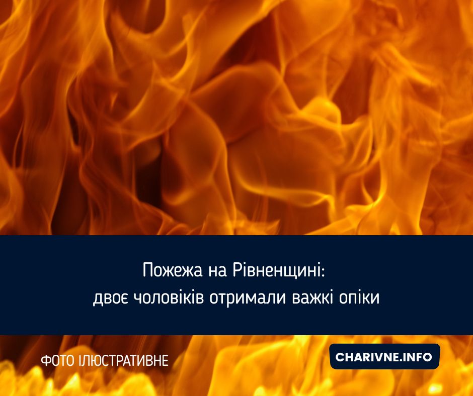 Пожежа на Рівненщині: двоє чоловіків отримали важкі опіки