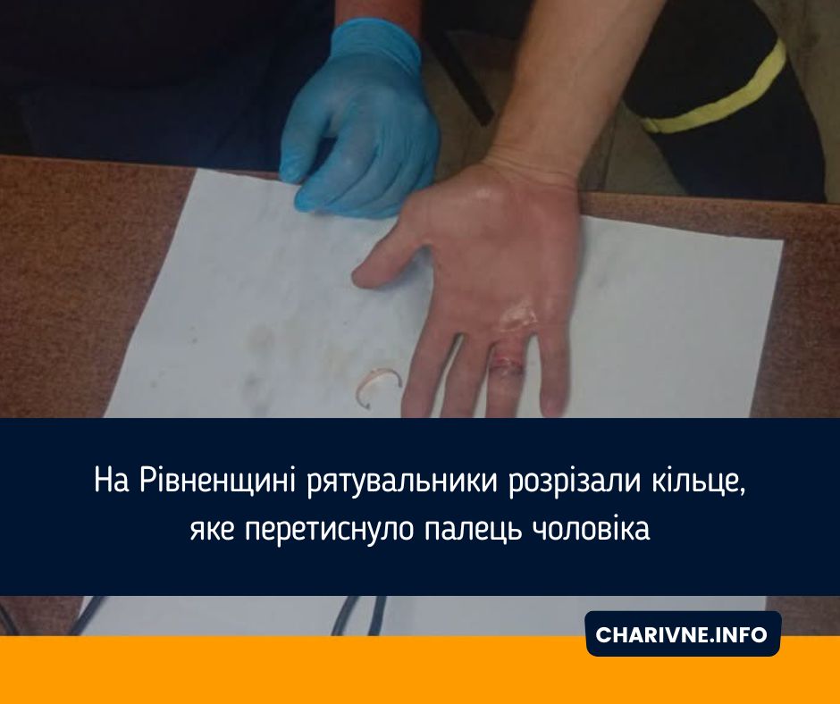 Фото ілюстративне