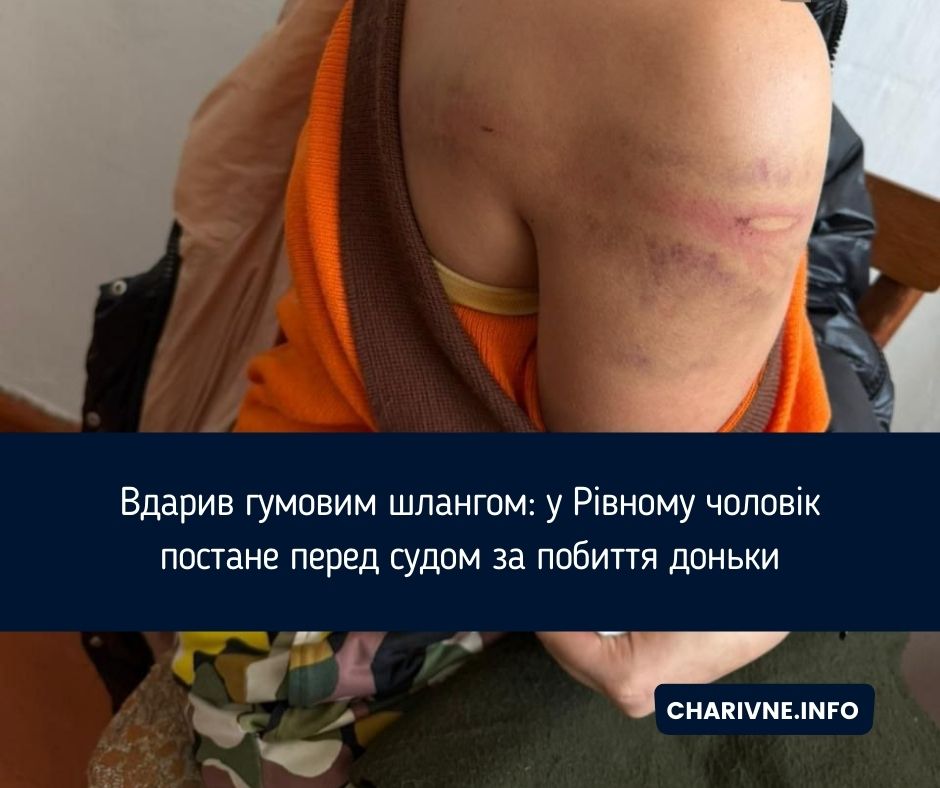 Фото ілюстративне