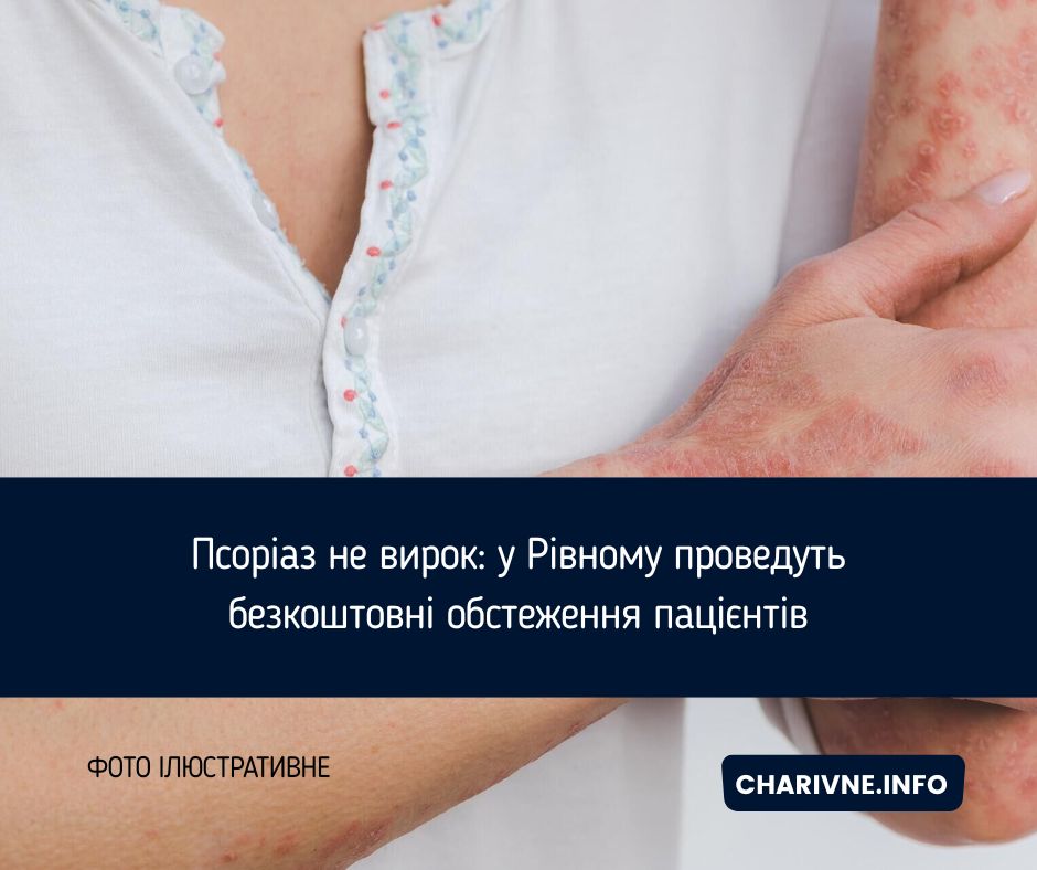 Фото ілюстративне